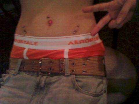 Microdermals, Death by F.Y.E. 