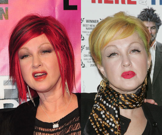 Cyndi Lauper