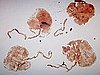 What to Do With Placenta