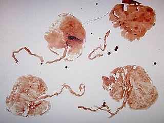 What to Do With Placenta
