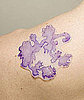 New Skin Exhibition at the Wellcome Collection in London