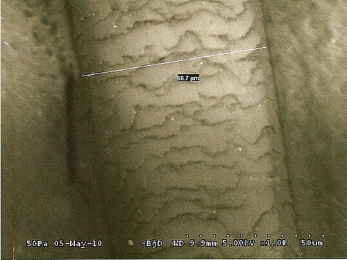 Hair Under a Microscope