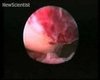 Ever Wonder What Ovulation Looks Like? 