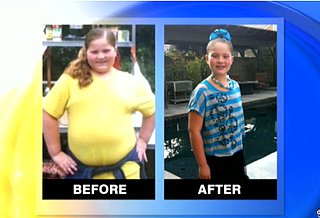 9-Year-Old Loses 66 Pounds