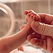 Babinski Reflex