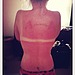 Kelly Osbourne With an Unfortunate Sunburn