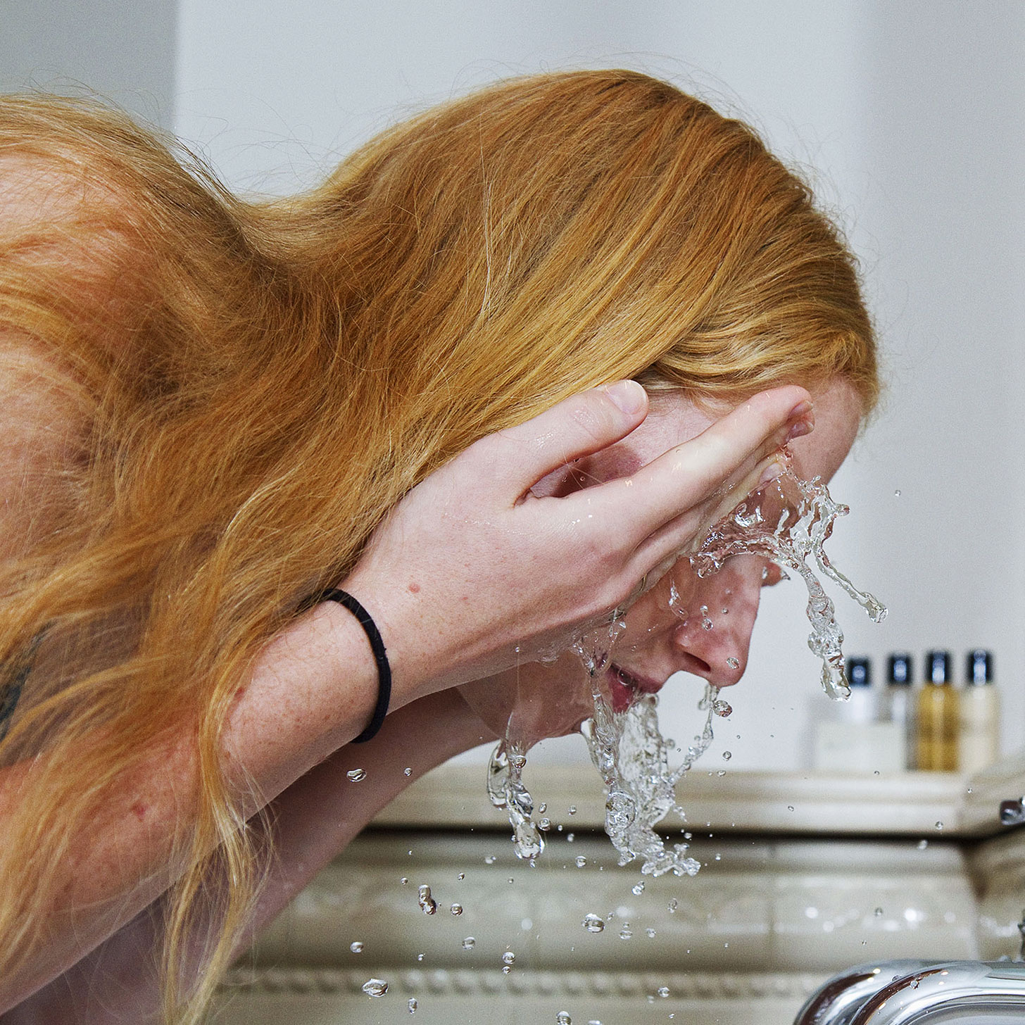 Is Dairy the Reason You're Breaking Out?