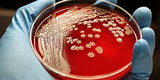 Households Can Harbor Drug-Resistant Superbug, Researchers Find Households Can Harbor Drug-Resistant Superbug, Researchers Find