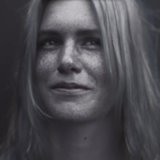 You'll Never Again Go a Day Without Sunscreen After Watching This