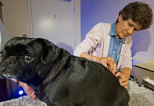 Acupuncture Acupuncture