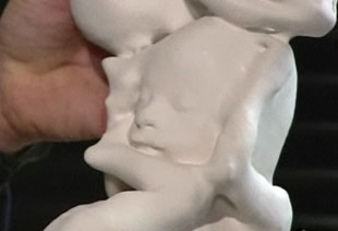 Would You Want to Hold Your Baby Before Birth?