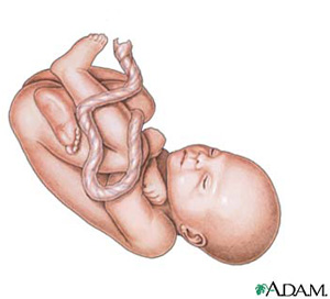 Babies Remember the Womb