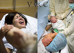 Vaginal Versus C-Section Birth Vaginal Versus C-Section Birth