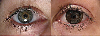 Wear Contact Lenses? Keep These in Mind