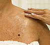 Blame Your Family For Skin Cancer?