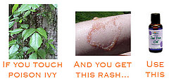 Defeat Poison Ivy With Tea Tree Oil