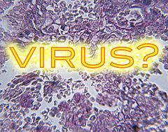 Speak Up:  Viral Obesity