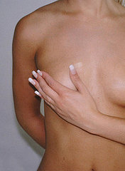 Mastitis