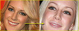 Heidi's New Lips??..