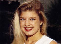 Everybody says Fergie has had Surgery but...