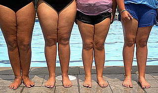 Should the Government Tell People to Lose Weight?