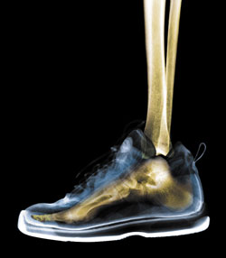 Avoid Shin Splints With Heel Walks 
