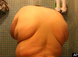 Obese Inmate Sues Jail Because He's Lost 100 Pounds