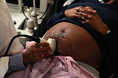 Did You Choose To Get Prenatal Tests? 