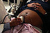 Did You Choose To Get Prenatal Tests? 