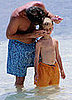 Kiddie Wellness: Sunburn