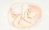 Baby Bump: Baby Born in the Caul