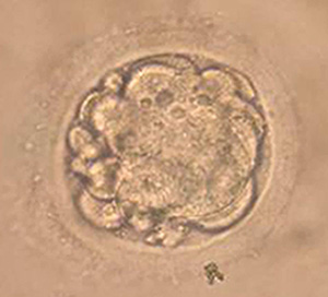 Fertility Term Exam