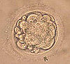 Fertility Term Exam