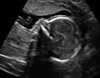 Sharing Ultrasound Pictures