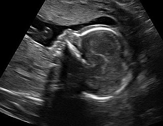 Sharing Ultrasound Pictures