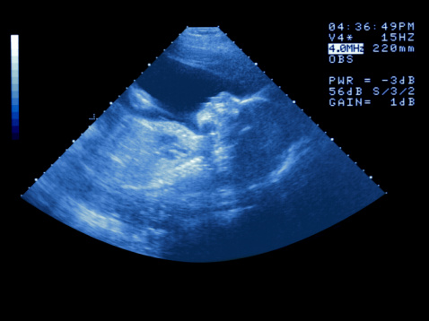 Prenatal Terms