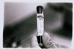 New York to Test Bronx for HIV New York to Test Bronx for HIV