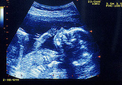Law to Require Woman to Look at Baby Right Before Abortion Law to Require Woman to Look at Baby Right Before Abortion