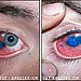 The first eye tattoo!
