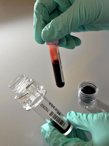 Why the Sight of Blood Makes You Feel Faint Why the Sight of Blood Makes You Feel Faint