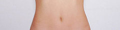 Is Your Belly Button an Innie or an Outie?