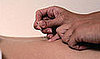Speak Up: What Alternative Medicine Practices Have You Tried?