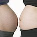 Comparing Pregnancies — Worst