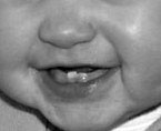 Lil Links: How to Handle a Baby Biting While Breastfeeding