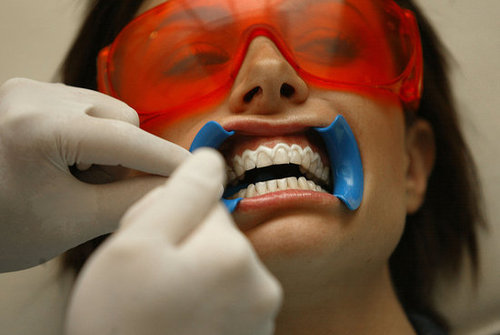 Tooth Whitening: Knowing Is Half the Battle, Say Dentists