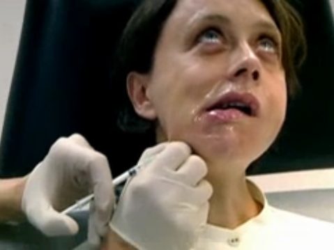 Super Botox Me
