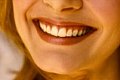 Wedding Prep:  Get Your Smile Ready