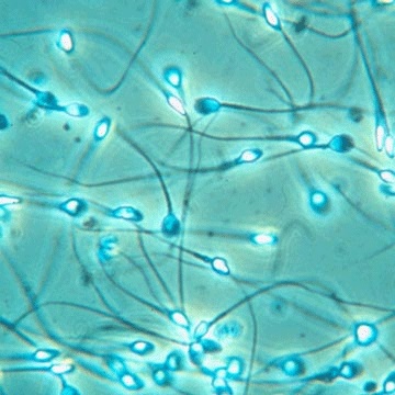 Life of a Sperm 