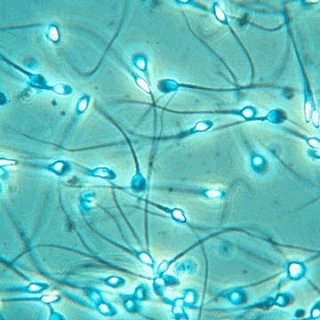 Life of a Sperm 