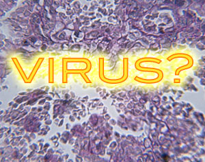Speak Up:  Viral Obesity